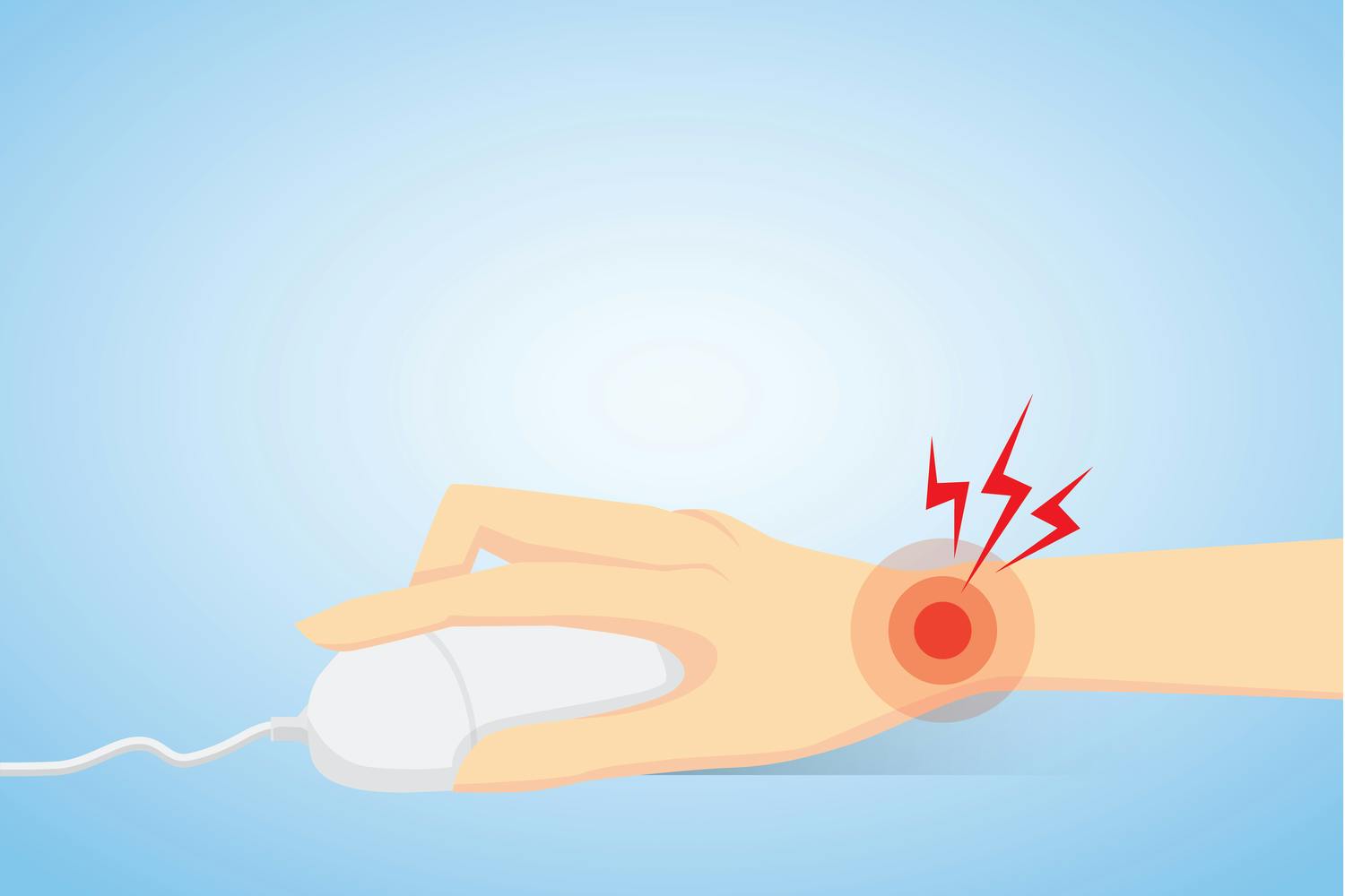 Au! Museskader og musearm er smerter som kan utvikle seg til karpaltunnelsyndrom.